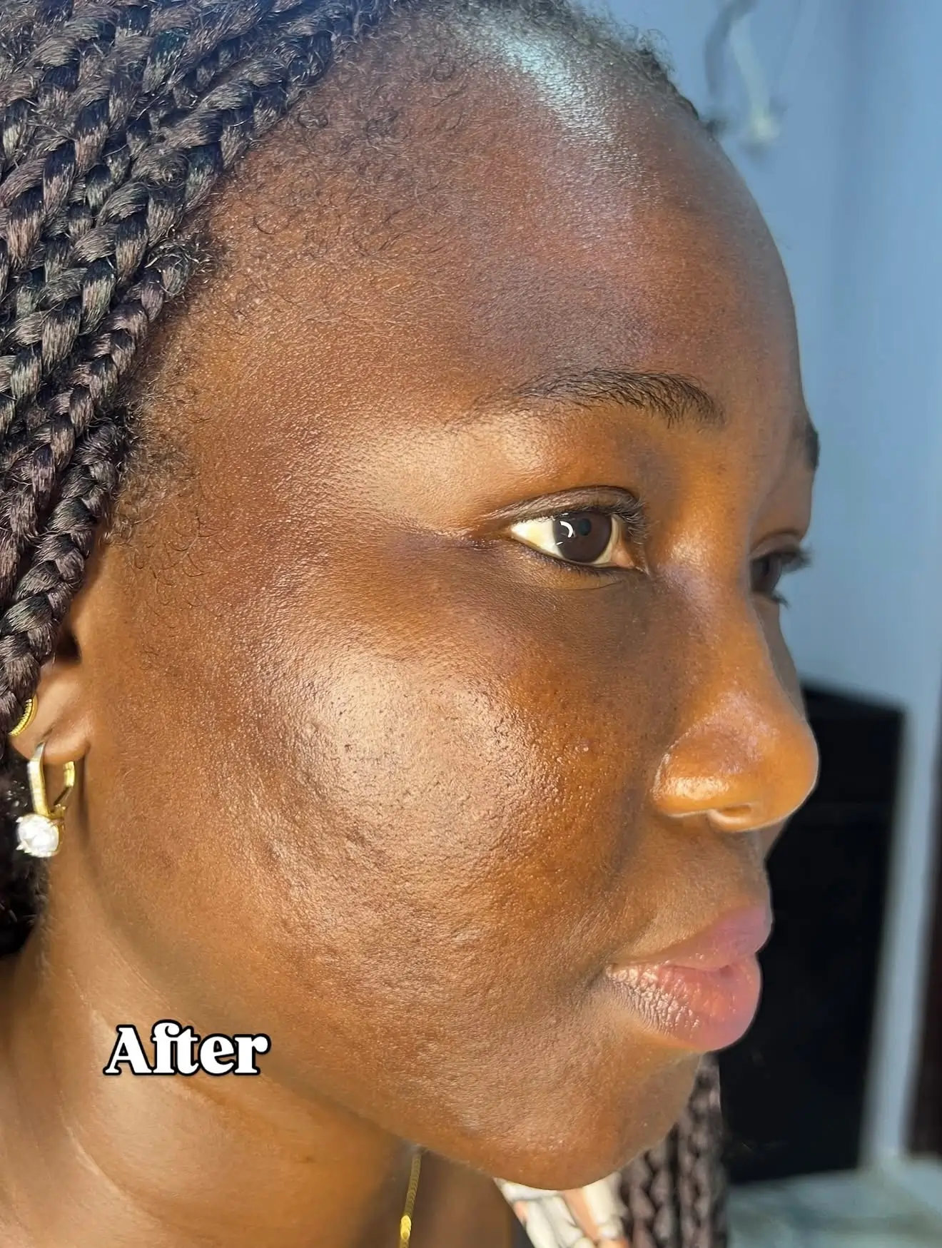 Skin after 8 weeks of CYOU